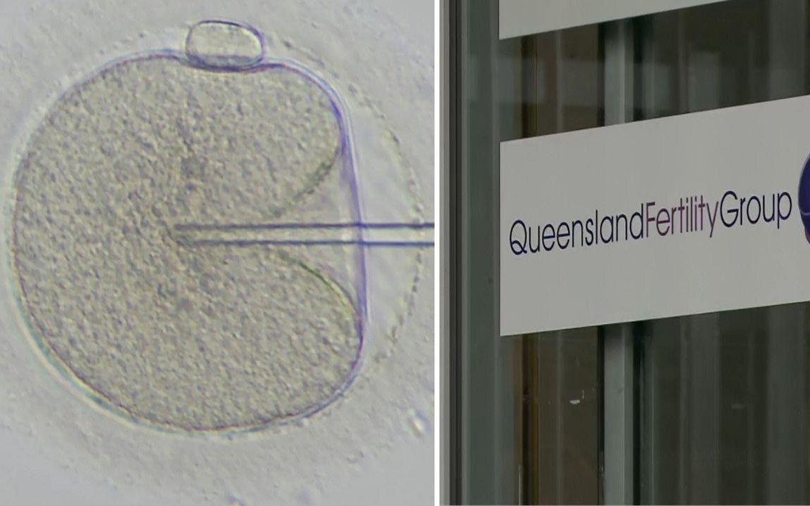 Sai sót nghiêm trọng trong thụ tinh trong ống nghiệm tại Australia